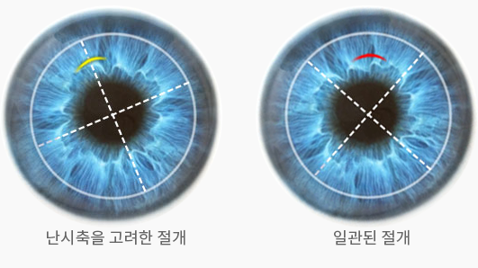 더욱정밀해진2.png