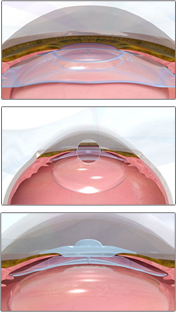 aqua_icl01.jpg