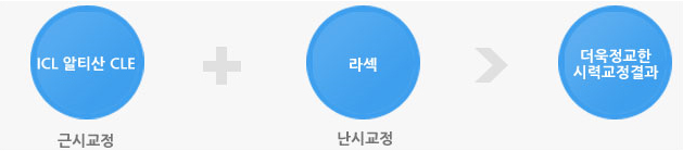아이옵틱스수술이란.png