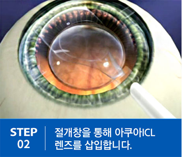 step02.png
